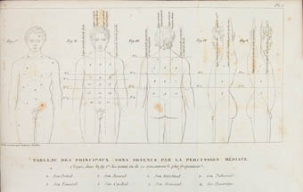 Esquema de Pierre Piorry sobre la percussió mediata. París, 1828. Biblioteca Historicomèdica de la Universitat de València.