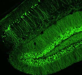 Neurones fluorescents del cervell dels ratolins objecte de l'estudi de la Universitat de València.