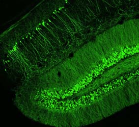 Neuronas fluorescentes del cerebro de los ratones objeto del estudio de la Universitat de València.