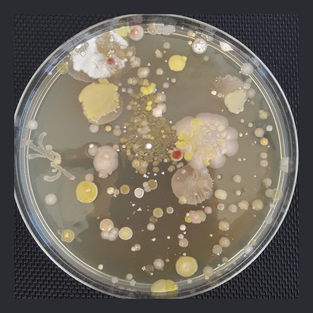 Placa de Petri amb colònies microbianes de formes i colors diversos.