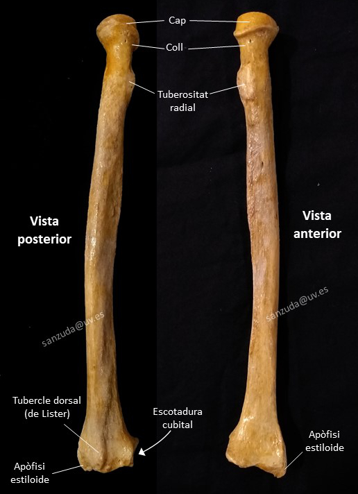 Dos fotografies del radi, vist des de davant i des de darrere, amb els seus accidents més importants retolats