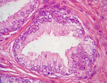 celulas de la prostata histologia