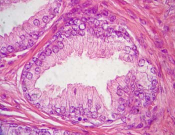 celulas de la prostata histologia)