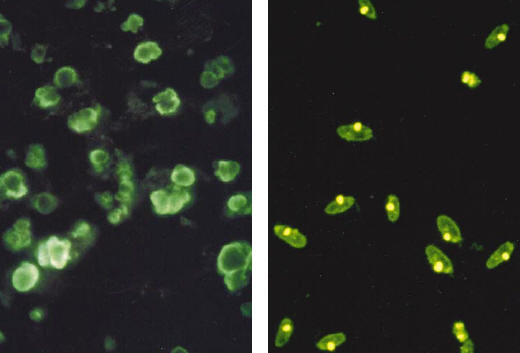 ANA con patrn de refuerzo periferico (izquierda) y Ac Anti-DNA ds utilizando como sustrato Crithidia llucillae