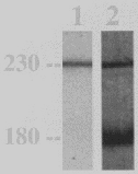 Gohestani RF. Bullous pemphigoid: from the bedside to the research laboratory. Clinics Dermatol 2001:19:690-6