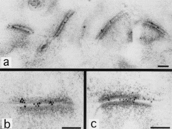 Ishiko A. Electron mycroscopy in diagnosis of autoimmune bullous disordes. Clinics in Dermatol 2001, 19:631