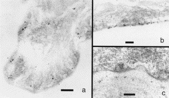 Ishiko A. Electron mycroscopy in diagnosis of autoimmune bullous disordes. Clinics in Dermatol 2001, 19:631
