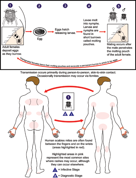 Life cycle of Sarcoptes scabiei