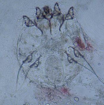Visin directa de una muestra obtenida mediante rascado superficial, en la que se observa un sarcopte scabiei adulto (hembra) con un huevo en su interior