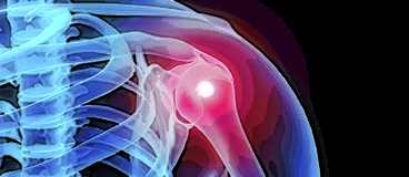 Radiografia muscle
