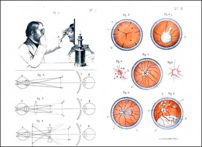 Examen de fondo de ojo con el oftalmoscopio. Litografas de Antonio Pascual Abad