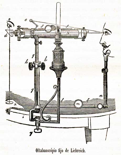 Oftalmoscopio fijo de Liebreich