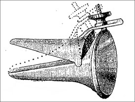 Esquema del rinoscopio de Duplay