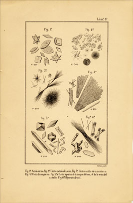 Cristales de ácido úrico, urato ácido de sosa, urato ácido de amoníaco, etc.