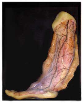 Modelo en cera de la piel y tejido celular subcutneo de la pierna