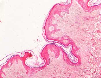 articulo traición Delincuente Prácticas de Histología (Podología)