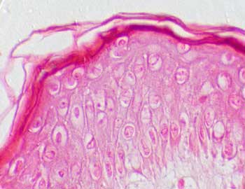 articulo traición Delincuente Prácticas de Histología (Podología)