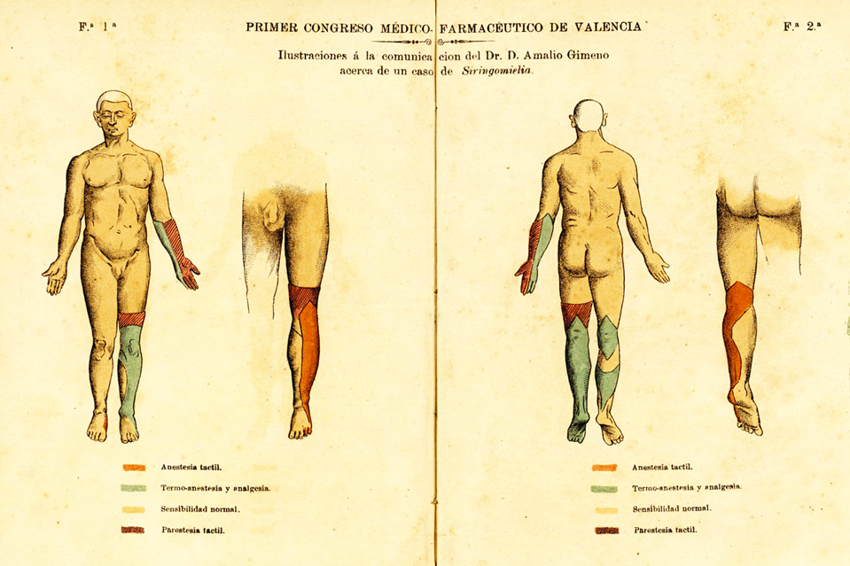 Ilustración de la comunicación presentada de Amalio Gimeno