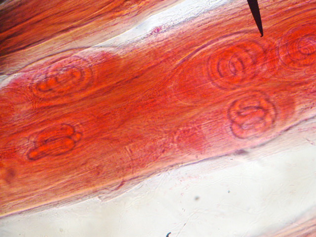 Trichina
