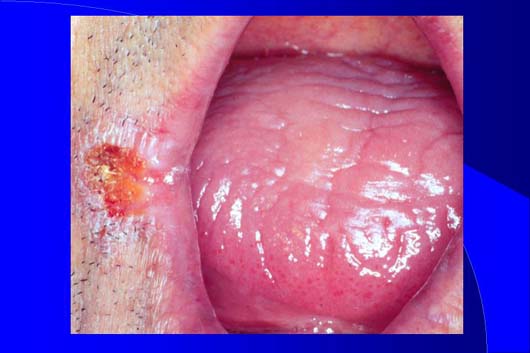 Diapositiva11