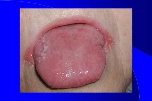 Diapositiva13
