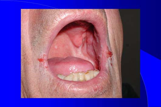 Diapositiva14