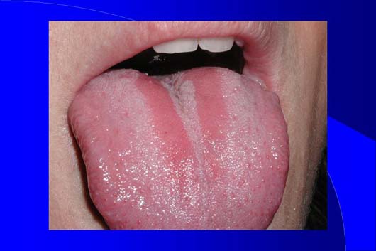 Diapositiva4