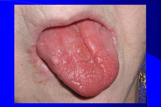 Diapositiva5