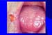 Diapositiva11