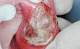 leucemia06.jpg
