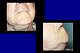 leucemia11.jpg