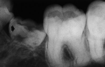 Figura 4