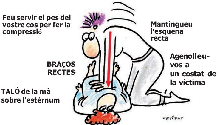 Reanimacion Cardiopulmonar