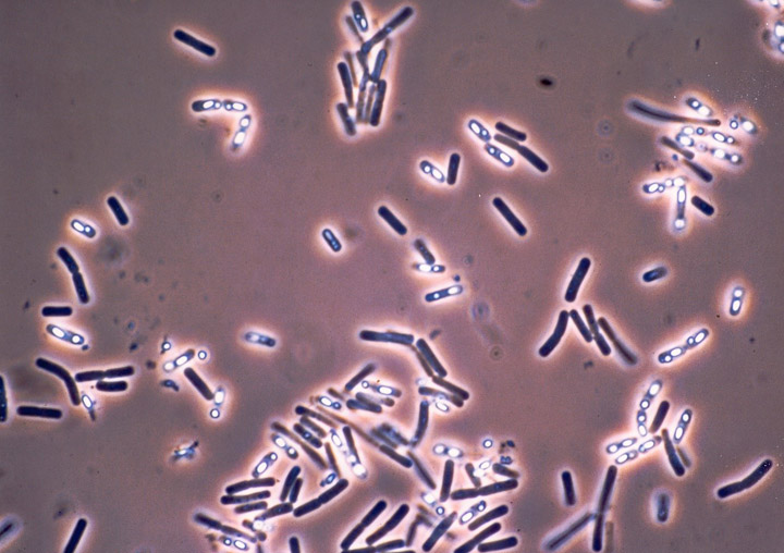 Окраска спор бактерий. Bacillus Cereus микроскопия. Bacillus subtilis микробиология. Бациллы и клостридии. Bacillus subtilis споры.