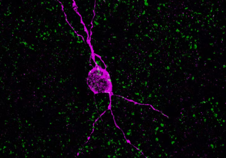 Neurona inmadura en una mujer de 60 años. Foto: Simona Coviello.