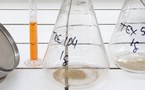 Nous tractaments de las arítmies auriculars