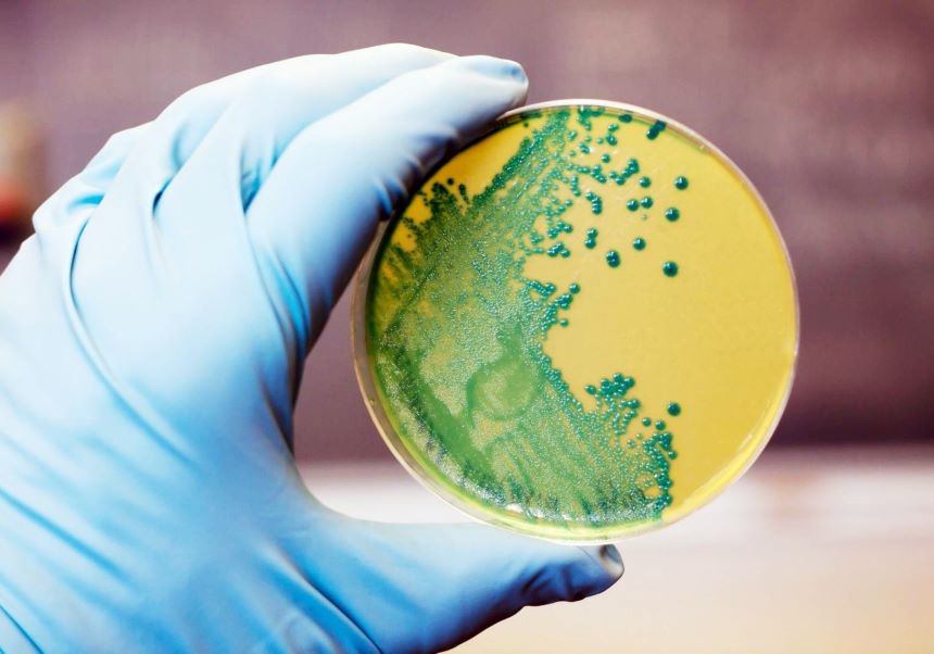 : Listeria monocytogenes que crece en una placa de agar. Créditos: Envato