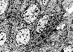 Imagen de Microscopia Electrónica