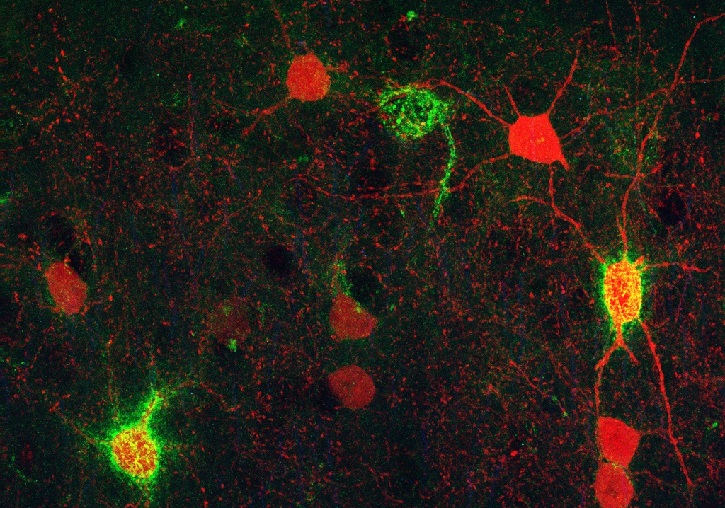 Microfotografía de la corteza prefrontal de un ratón adulto que muestra neuronas PV+ (en rojo) y PNN (en verde).