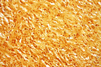 ‘Treponema pallidum’, el bacteri causant de la sífilis. ©2011 Michael Bonert