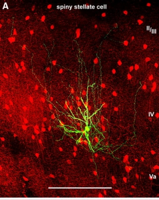Interneurona fluorescente