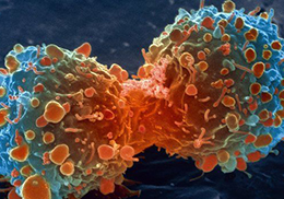 células cancer