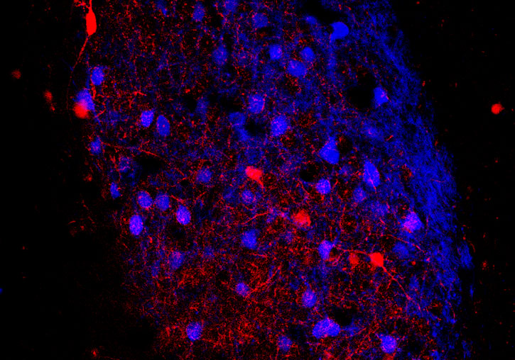Imatge de l’amígdala basolateral d’un ratolí Thy1 on es poden observar les neurones excitadores (de color blau) i les neurones inhibidores PV+ (de color roig).