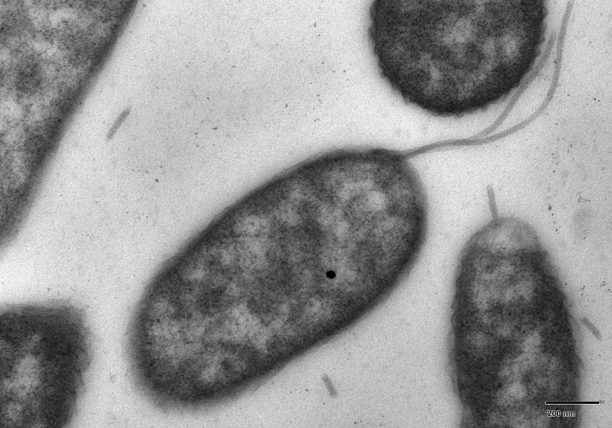 Imagen microscópica de <i>Vibrio vulnificus</i>, la bacteria carnívora marina.