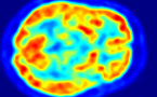 cervell