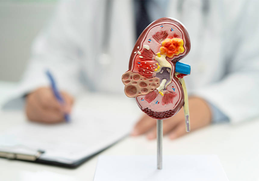 Un doctor estudia amb un model humà de renyó.
