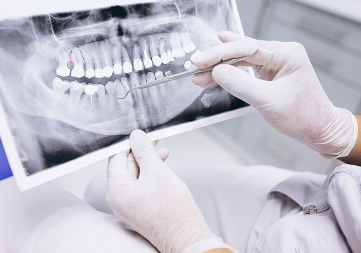 Radiografia dental