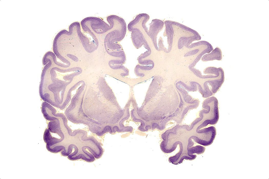 Sección histológica de cerebro humano