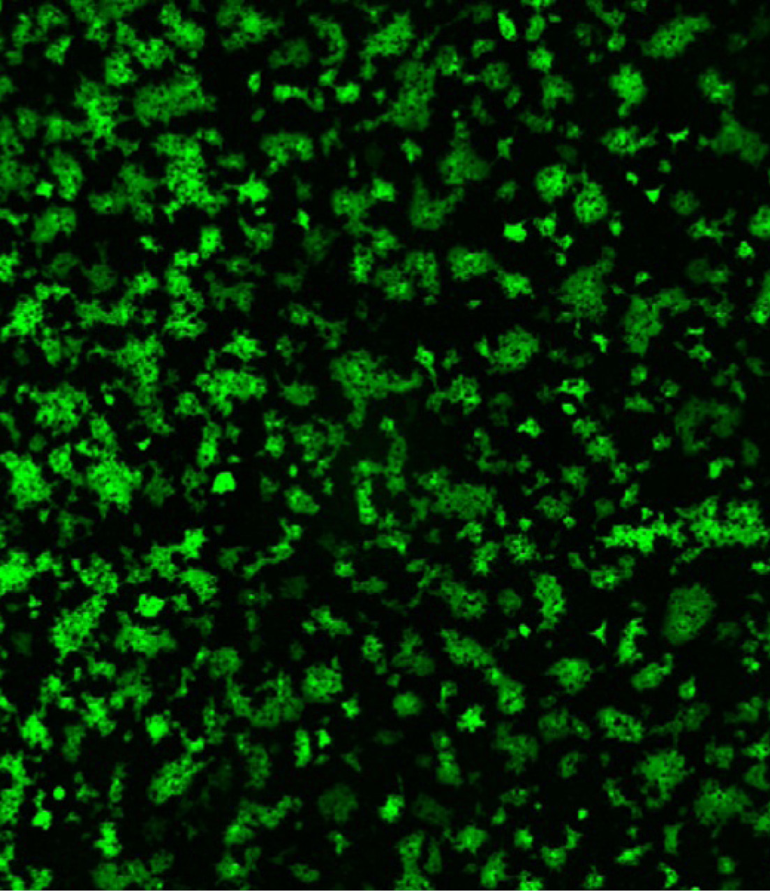 Virus vist per microscopi