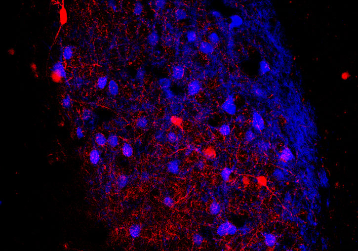 Imagen de la amígdala basolateral de un ratón Thy1 en que se pueden observar las neuronas excitadoras (de color azul) y las neuronas inhibidoras PV+ (de color rojo).
